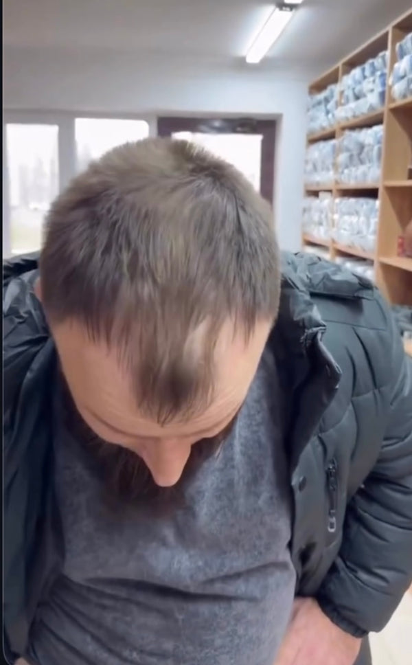 Après